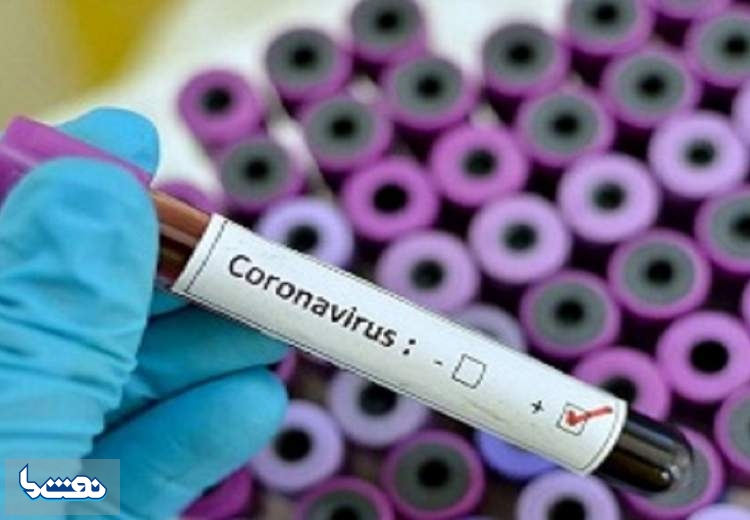 تب بالای ۳۸درجه در چه صورتی علامت کروناست؟